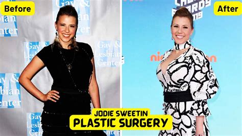 Jodie Sweetins plastic surgery thoughts